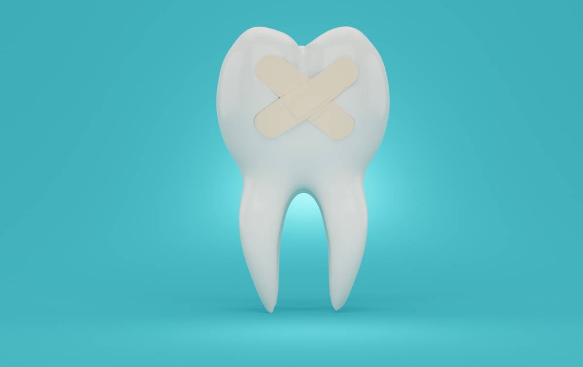 concept image of dental emergency damaged tooth