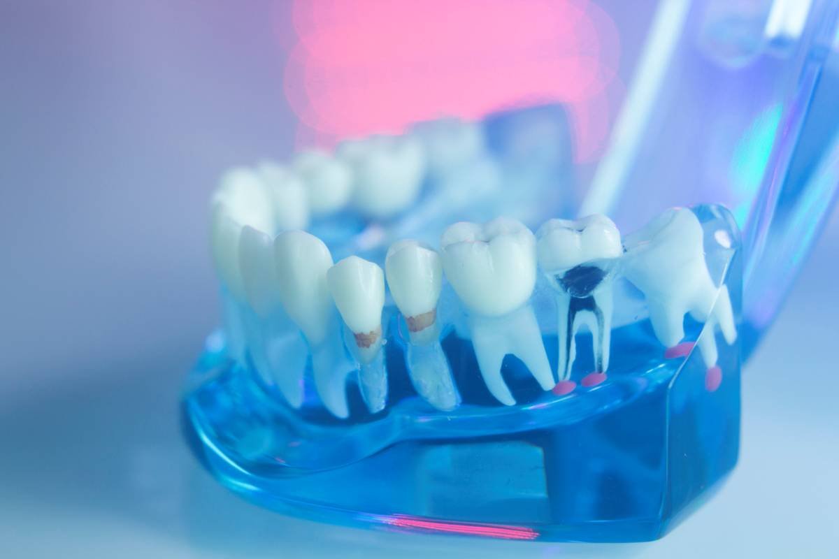 concept in root canal treatment improves health