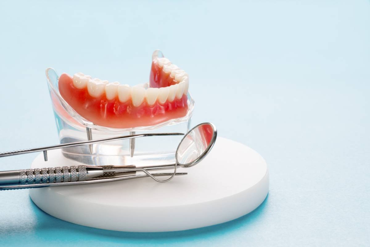 featured image: how to adjust to new implant dentures