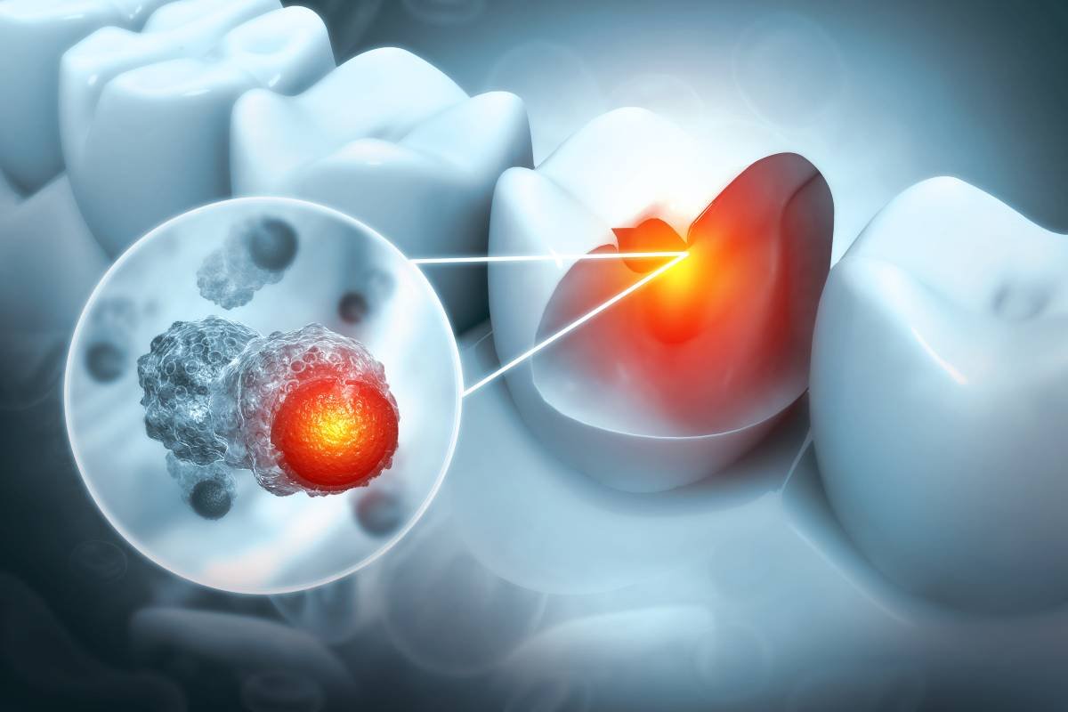 concept of tooth infection a emergency