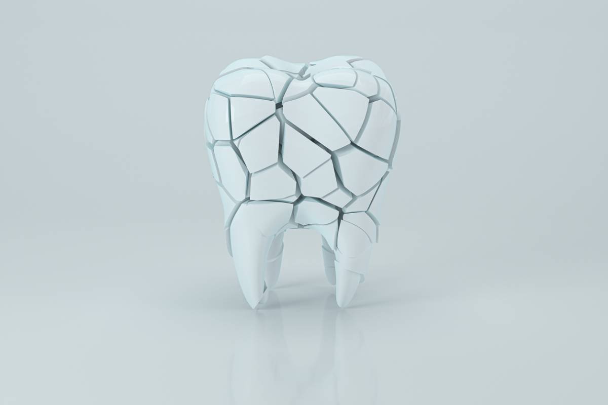 concept image of cracked crown tooth